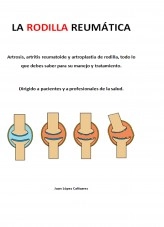 Libro LA RODILLA REUMÁTICA, autor juanlofish Libro LA RODILLA REUMÁTICA, autor juanlofish
